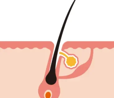 Chute de cheveux : comprendre le cycle pilaire et les solutions naturelles efficaces 6 chute de poil LARA SENSE
